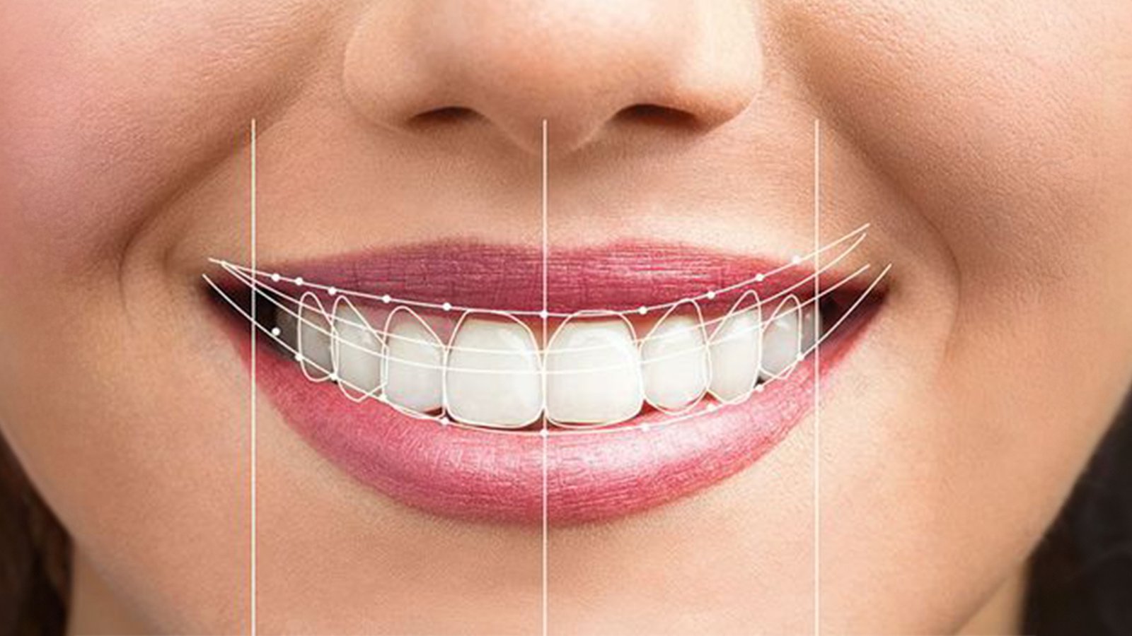 Cosmetic dentistry smile makeover at Dr. Madhuri Bhandari Dental Clinic in Pimpri Chinchwad Pune
