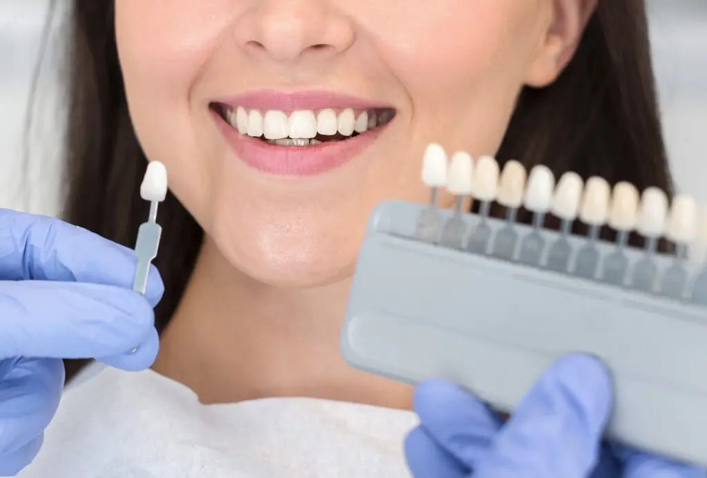 Cosmetic dentistry smile makeover at Dr. Madhuri Bhandari Dental Clinic in Pimpri Chinchwad Pune