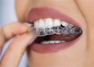 dental aligners at dr madhuri dental clinic in pimpri chinchwad
